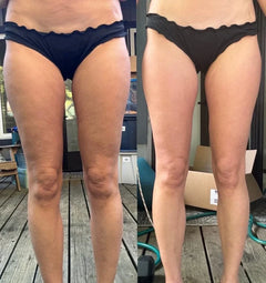 FitSculpt™ Anti-Cellulite High-Waisted Shaping Leggings