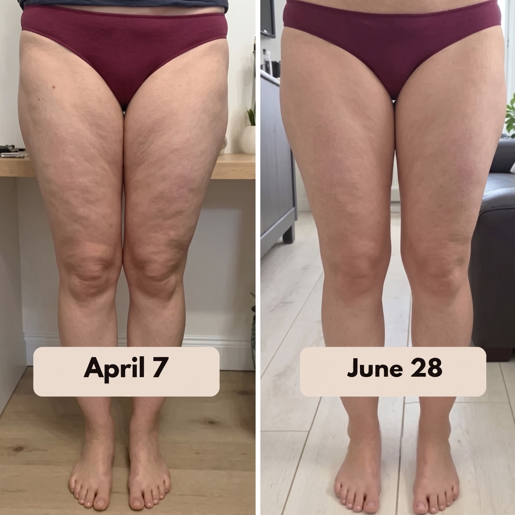 FitSculpt™ Anti-Cellulite High-Waisted Shaping Leggings