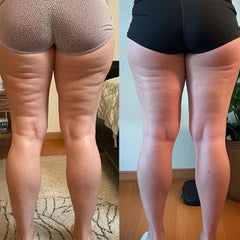 FitSculpt™ Anti-Cellulite High-Waisted Shaping Leggings