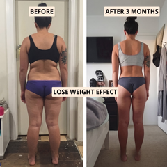 FitSculpt™ Anti-Cellulite High-Waisted Shaping Leggings